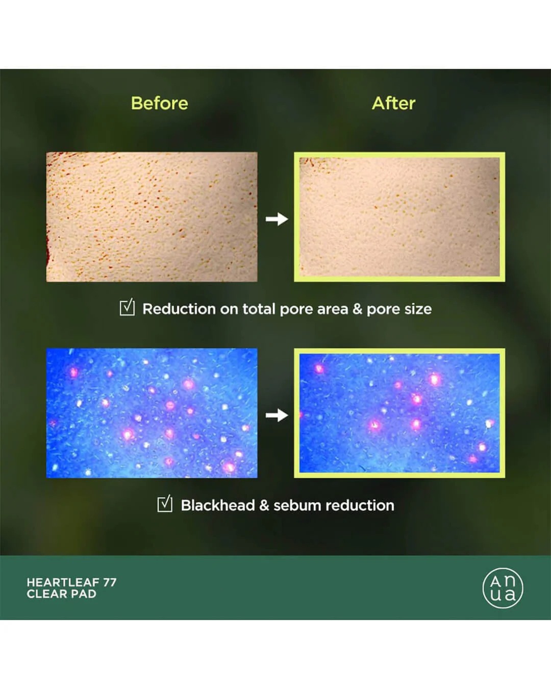 Heartleaf 77 Clear Pad - الصورة 4